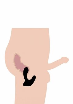 Silicone Prostate Stimulator + Remote Control with 10 Speeds