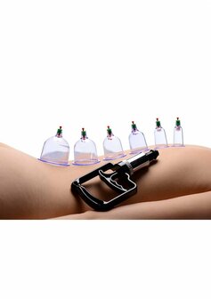 Sukshen - 6-Piece Cupping Set